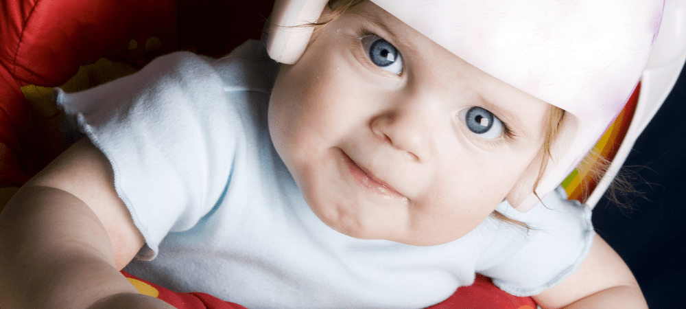 Why Can't You Get a Plagiocephaly Helmet on the NHS?
